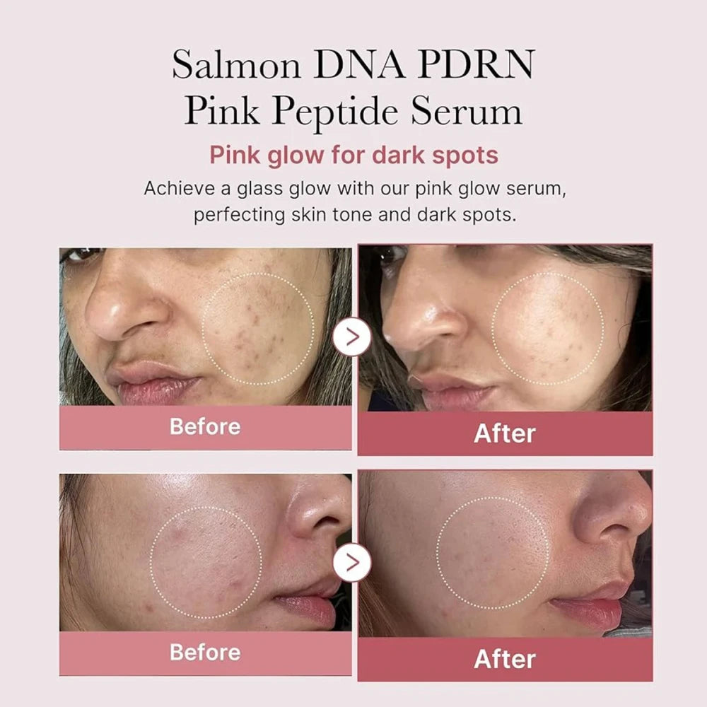 Medicube Salmon DNA Pink Peptide Serum